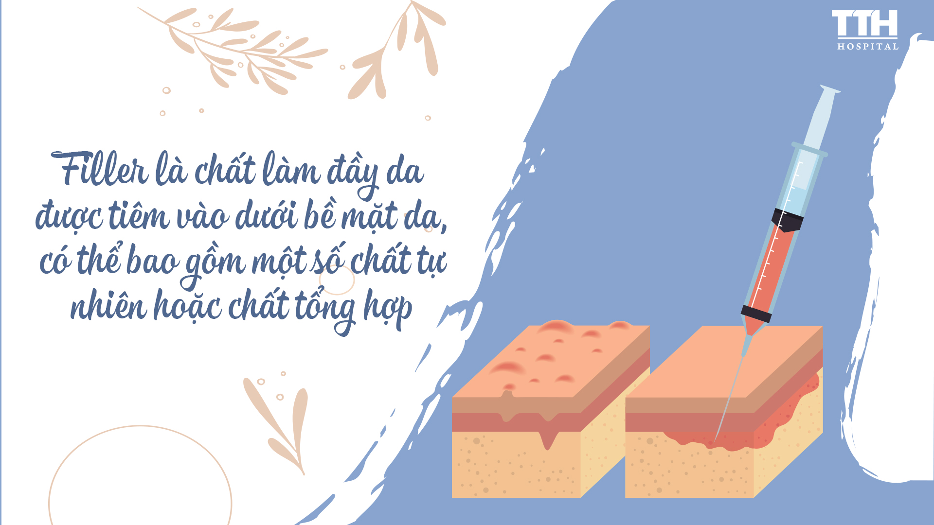 Filler là chất làm đầy được tiêm vào dưới da