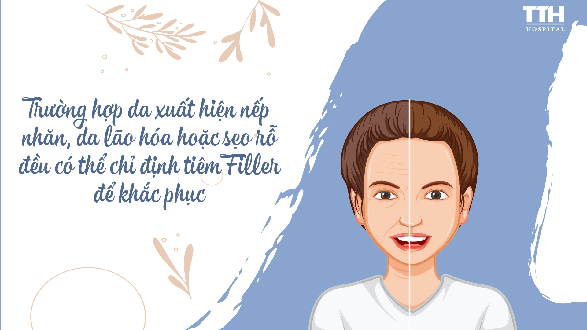 Tiêm Filler giúp làm căng da nhưng không phải ai cũng được chỉ định tiêm