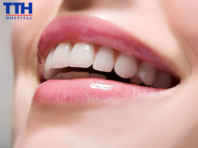 5 LỢI ÍCH CỦA VIỆC KHÁM RĂNG ĐỊNH KỲ