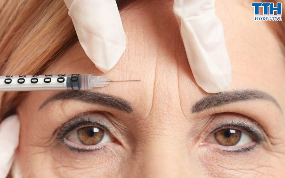 Tiêm giúp làm ngăn ngừa sự xuất hiện của nếp nhăn