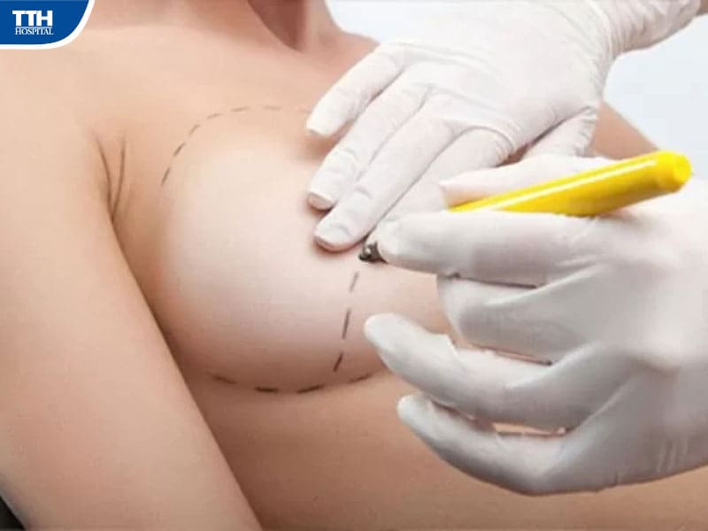 Bệnh viện Thẩm mỹ Thái Thượng Hoàng - Địa chỉ nâng ngực uy tín