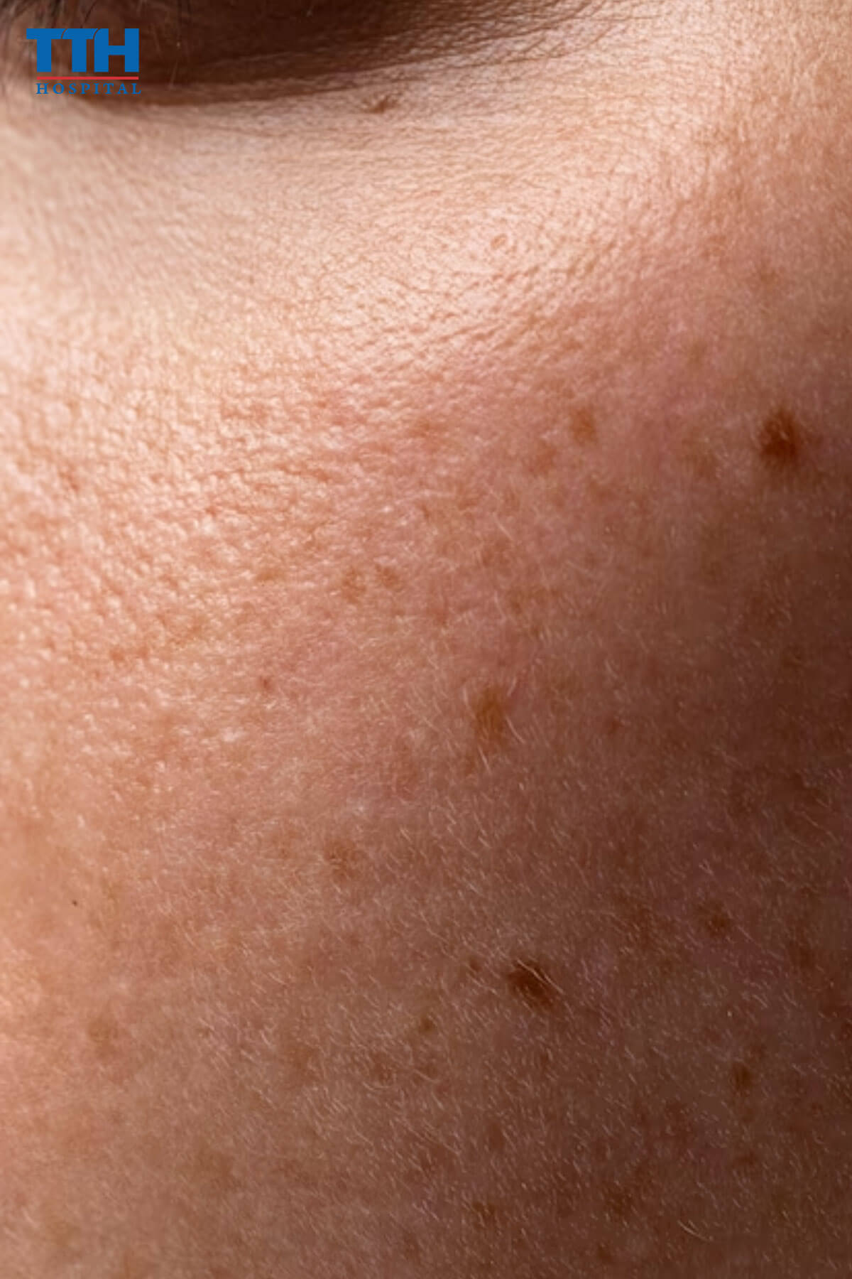 Biểu hiện của da khô tại Vinh, nghệ an