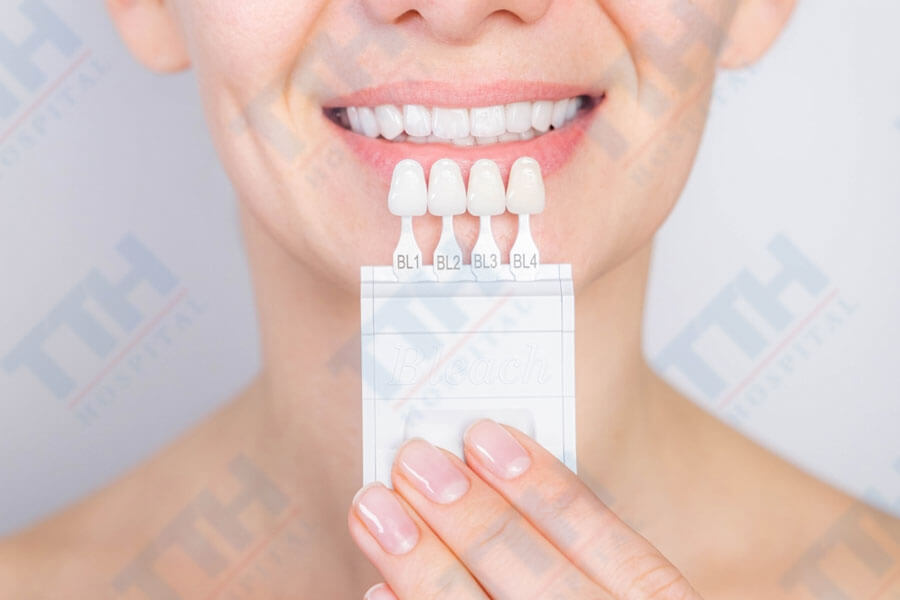 Các loại răng sứ phổ biến