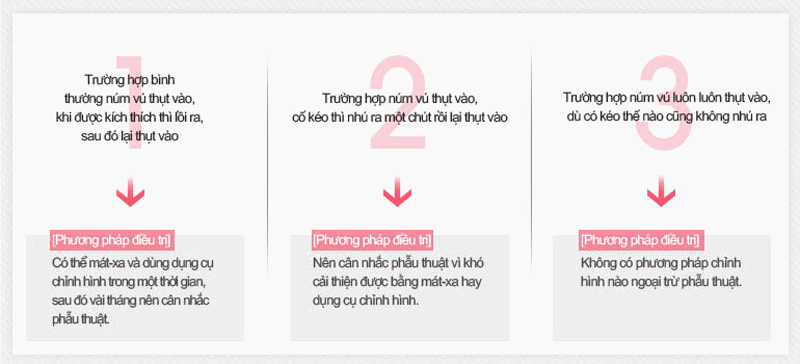 Phương pháp phẫu thuật kéo núm vú ra đời đã trở thành một giải pháp