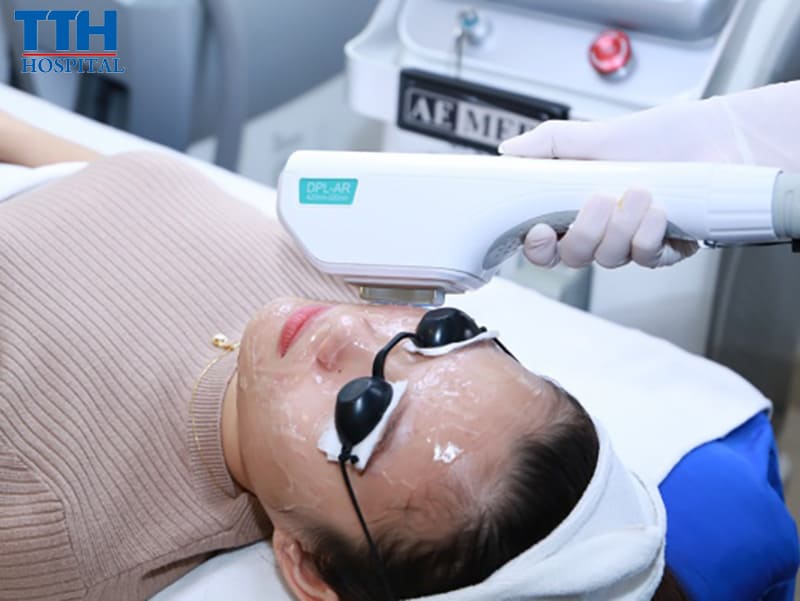 Các phương pháp điều trị mụn hiệu quả