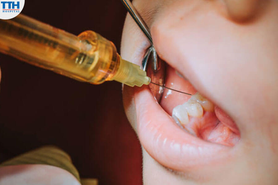 Các Phương Pháp Gây Mê Điều Trị Răng Ở Trẻ Em Thông Thường