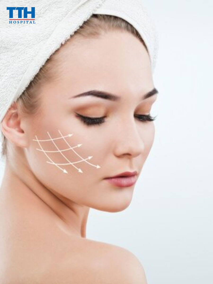 Các yếu tố ảnh hưởng đến hiệu quả của căng chỉ sinh học