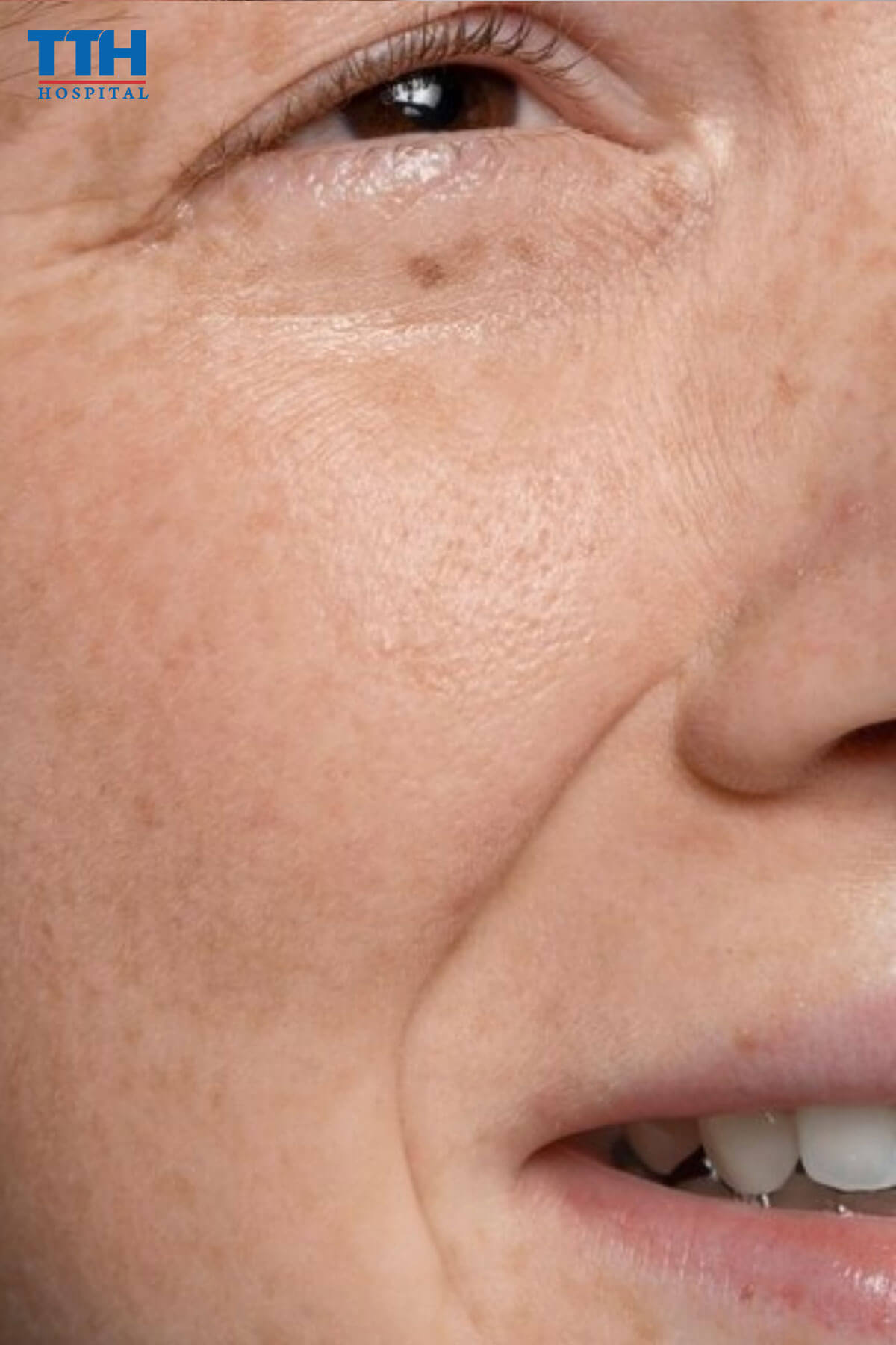  Cách kiểm tra da bạn có phải da khô không tại Vinh, nghệ an