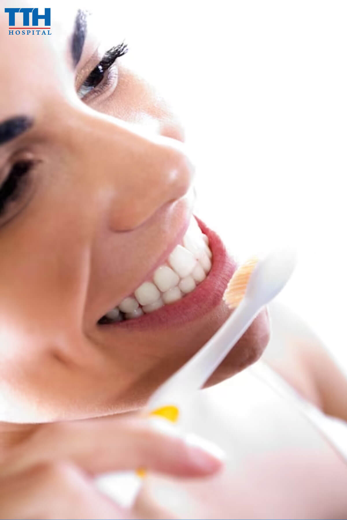 Cách phòng tránh nhổ răng khi niềng răng tại vinh nghệ an