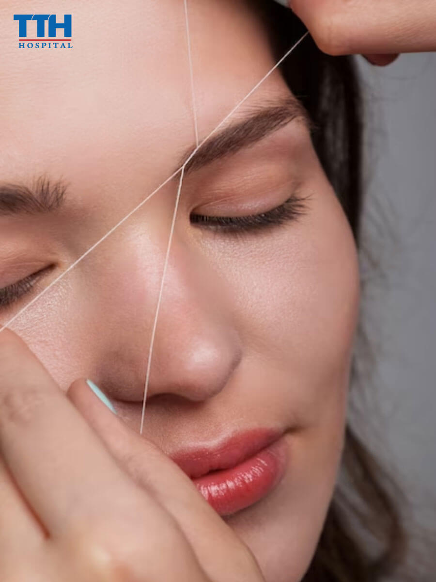 Căng chỉ sinh học tại vinh nghệ an: Liệu có thực sự tốt?