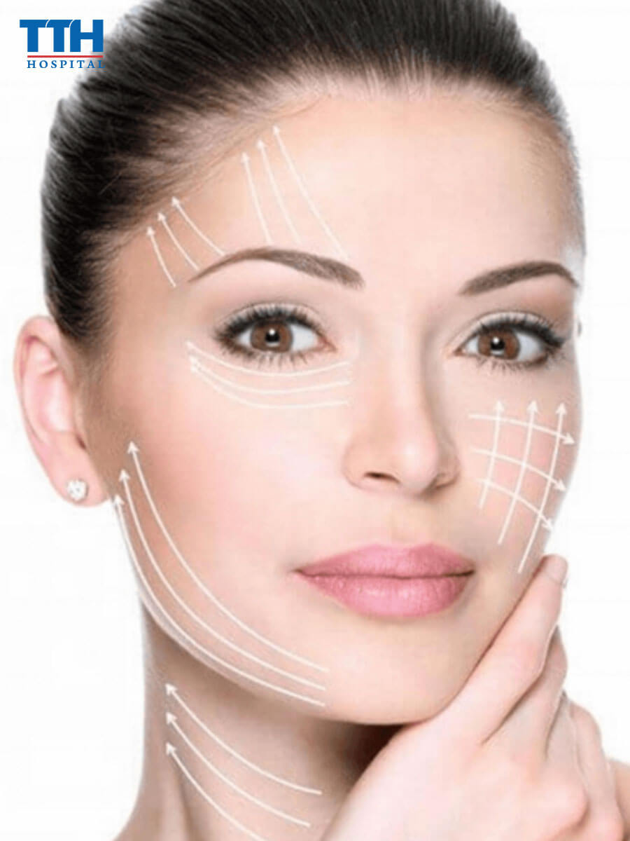 Căng da mặt bằng chỉ sinh học có an toàn không