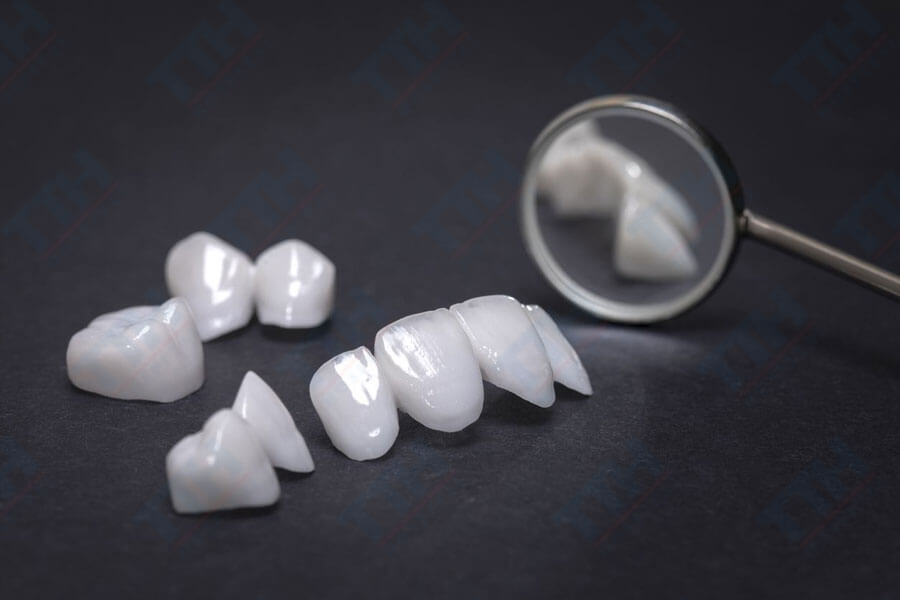 Cấu Tạo và Thành Phần Của Răng Sứ Veneer Lisi