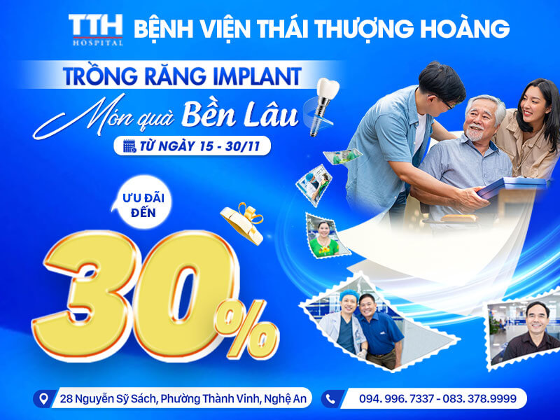 CHƯƠNG TRÌNH HẤP DẪN DÀNH RIÊNG CHO DỊCH VỤ