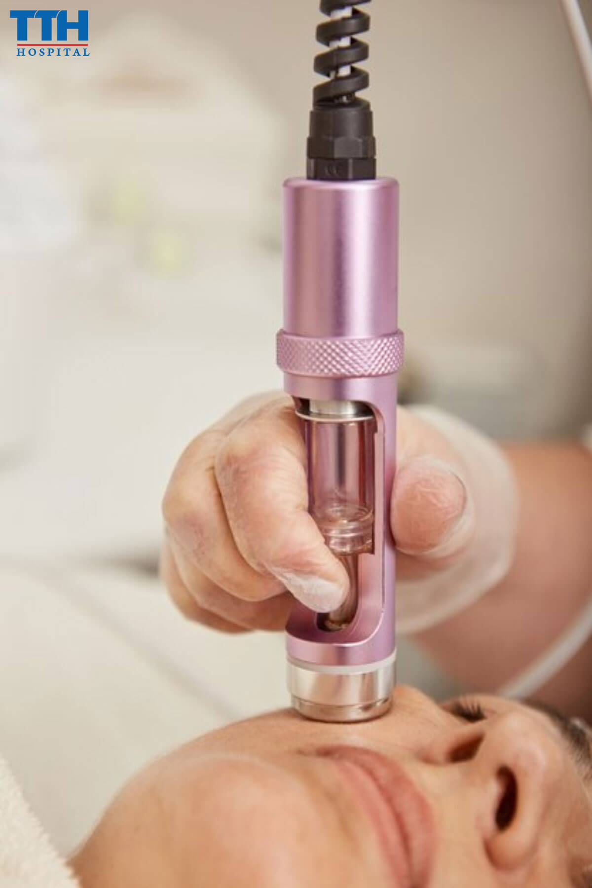 Công Nghệ Điện Di Tử để Trị Nám tại Vinh, Nghệ An