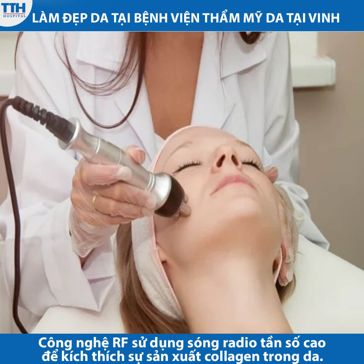 công nghệ RF làm đẹp da