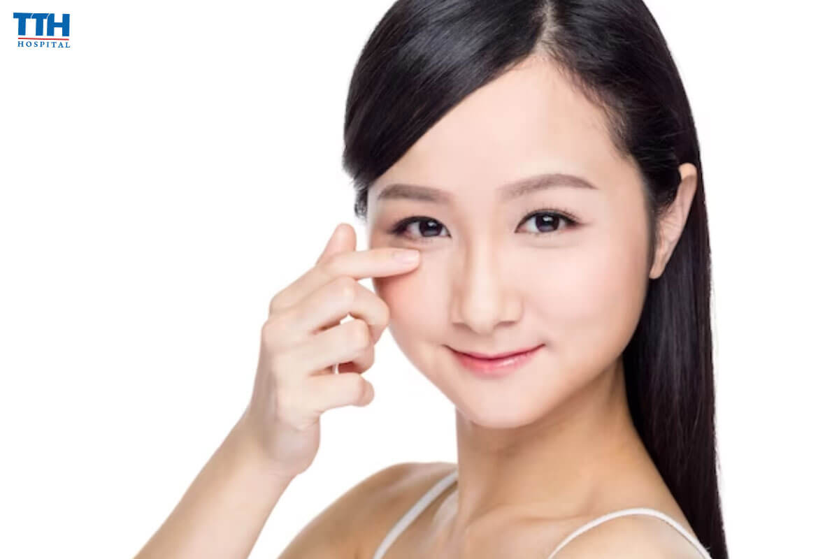 Cắt mí Mini Deep là gì?