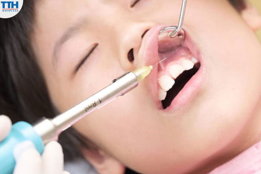 Điều Trị Răng Ở Trẻ Em Bằng Phương Pháp Gây Mê Là Gì?