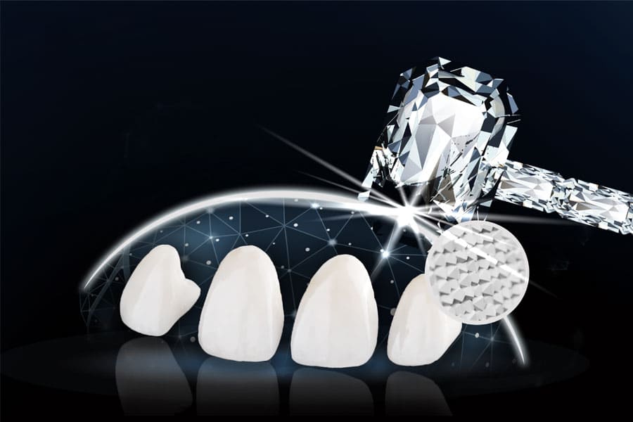 Độ bền của răng sứ Orodent vượt trội, đáp ứng nhu cầu ăn nhai tối ưu