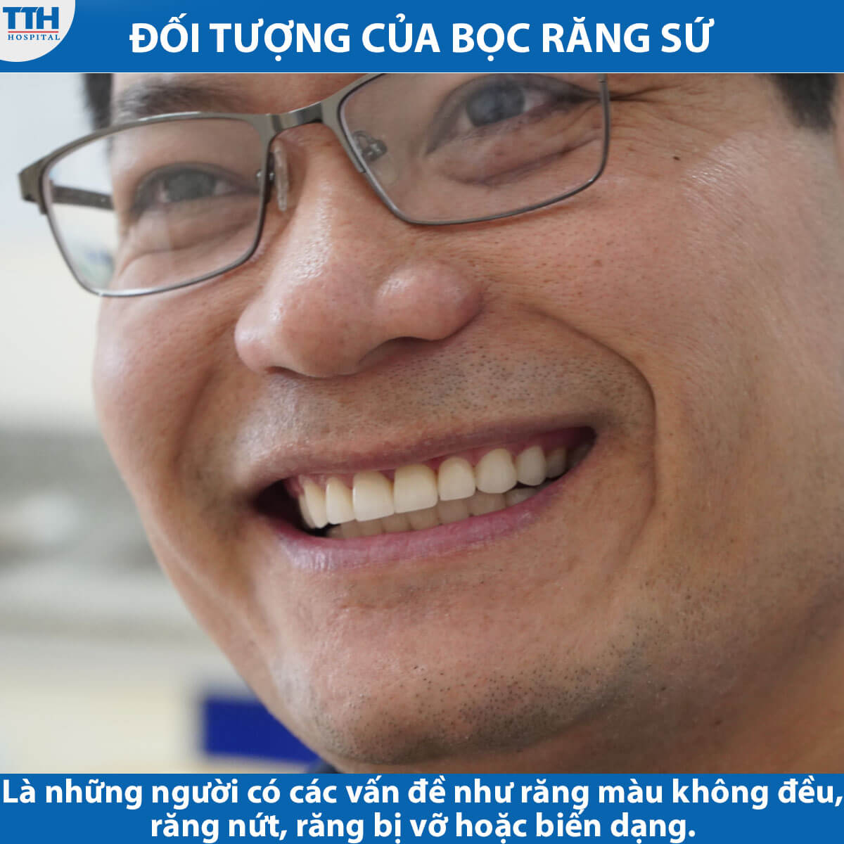 Đối tượng của bọc răng sứ