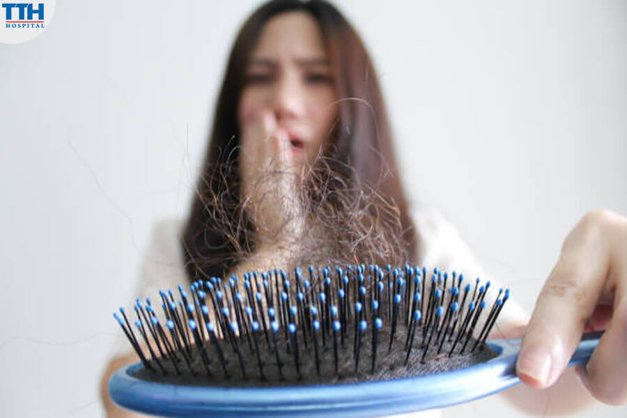 Đối tượng rụng tóc nhiều là ai?