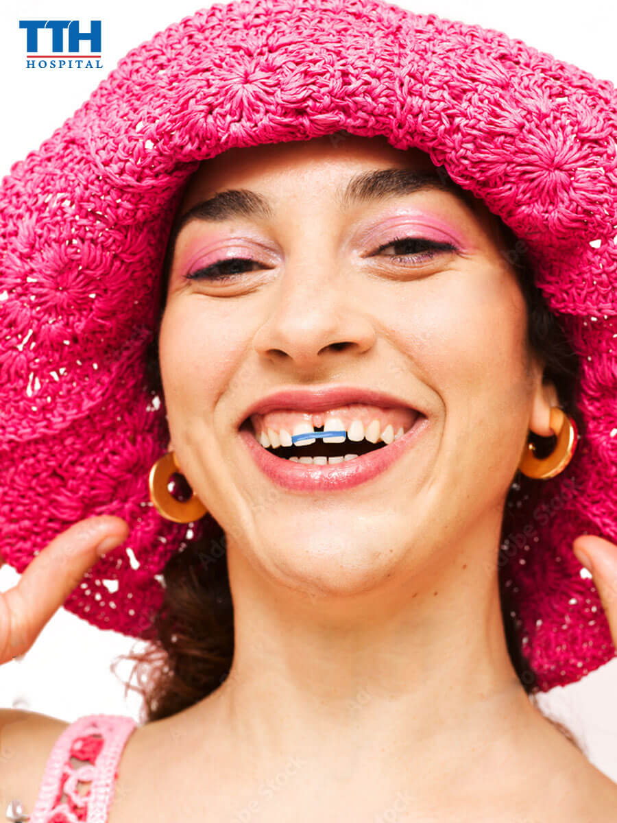 Dùng dây thun để làm khít răng thưa