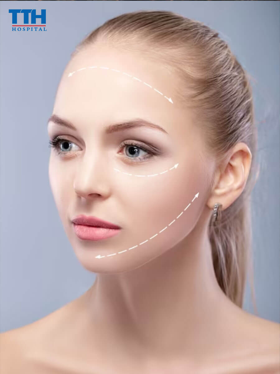 Giới thiệu về Căng chỉ sinh học tại vinh nghệ an
