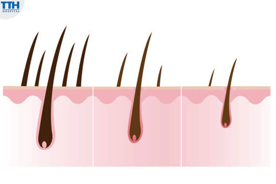 Hiểu Rõ Về Rụng Tóc