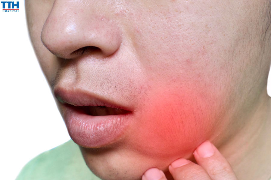 Hiểu về quá trình sưng sau trồng răng implant