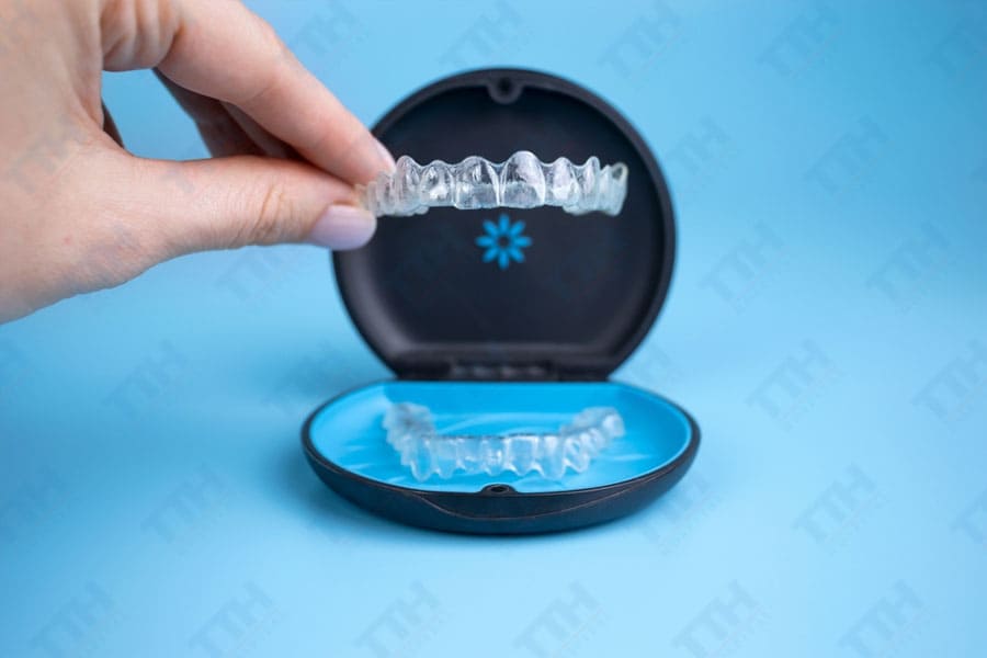 Invisalign So Với Niềng Răng Truyền Thống