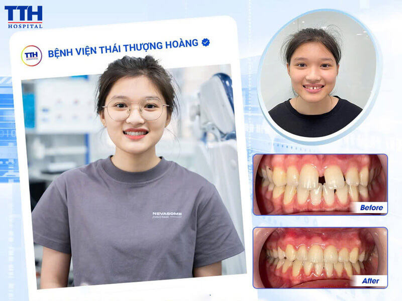 KHÁM PHÁ CÁC DỊCH VỤ NỔI BẬT TRONG CHƯƠNG TRÌNH NGÀY HỘI NHA NHI