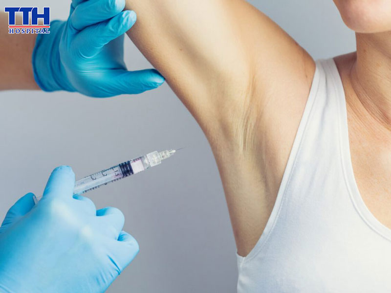 Khóa tuyến mồ hôi nách - Giải pháp loại bỏ mồ hôi nách an toàn, hiệu quả