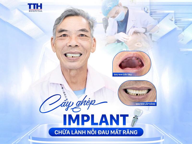 Lựa chọn chất lượng – lựa chọn an toàn & bền vững