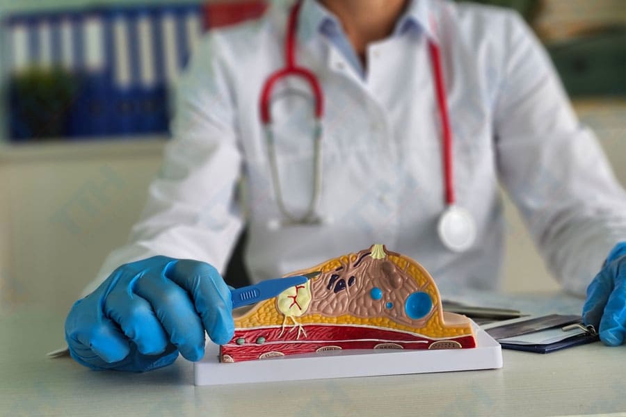 Lựa chọn phương pháp phù hợp giữa nâng ngực chảy xệ có và không đặt túi