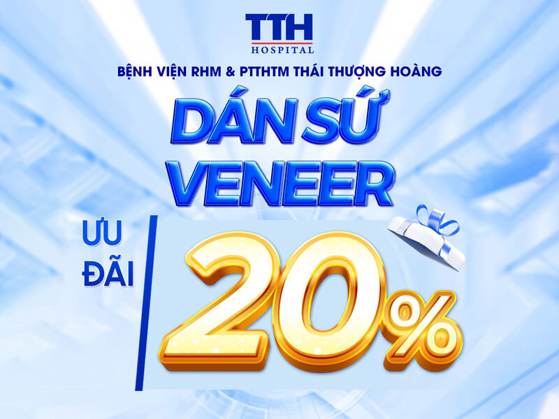 Mặt Dán sứ Veneer
