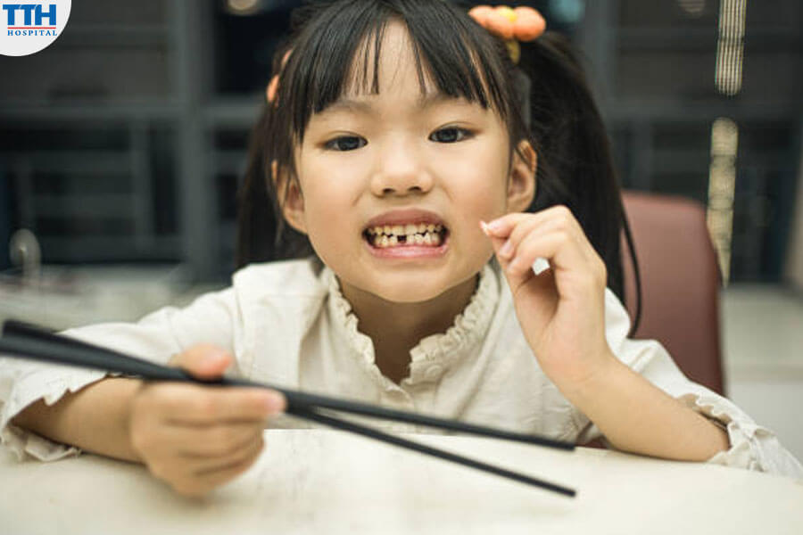 Mọc Răng Sữa và Chăm Sóc Răng Sữa Của Trẻ Có Ảnh Hưởng Như Thế Nào Đến Tương Lai Của Trẻ