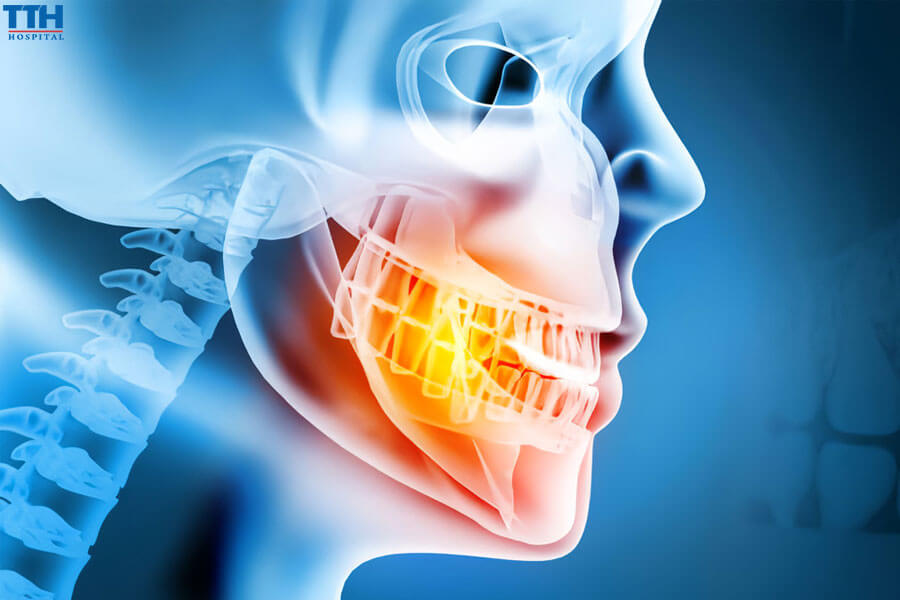 Mối quan hệ giữa trồng răng implant và sức khỏe xương hàm