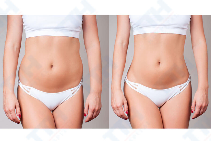 Mục đích của phẫu thuật thẩm mỹ