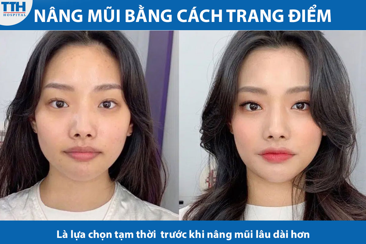 Nâng mũi bằng trang điểm là một lựa chọn tạm thời cho những người muốn thử nghiệm trước khi quyết định với phương pháp nâng mũi lâu dài hơn.