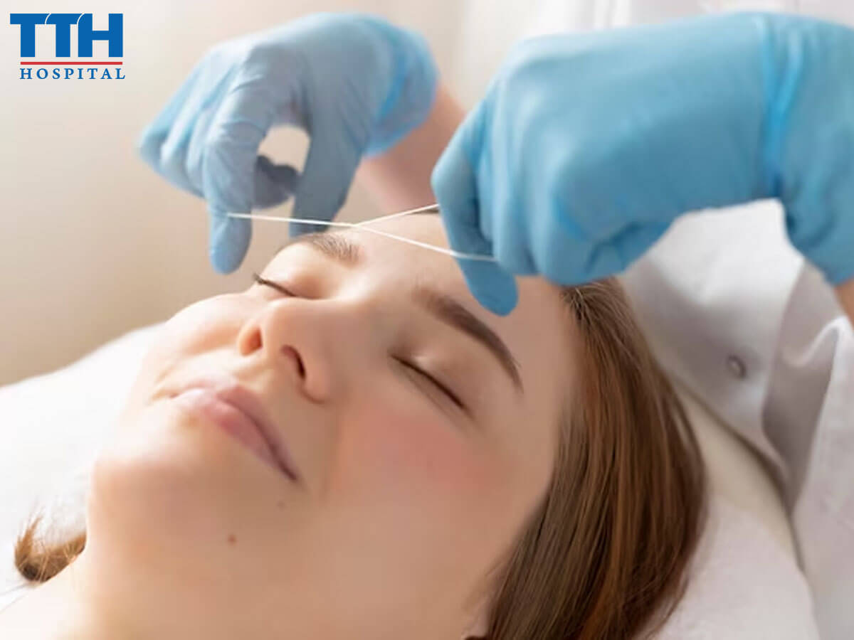 Nâng mũi chỉ là gì  - Nâng mũi chỉ tại Vinh Nghệ An