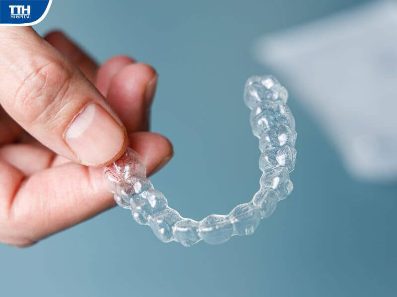 Những điều cần lưu ý khi niềng răng trong suốt cho trẻ