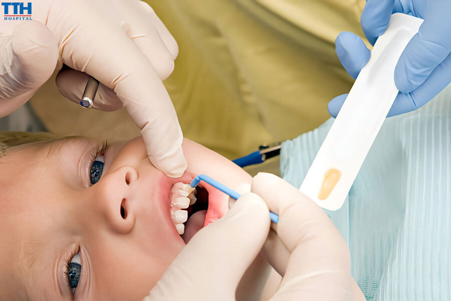 Những Đối Tượng Nên Sử Dụng Vecni Fluor