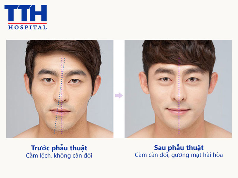 Quy trình phẫu thuật tại Bệnh viện Thái Thượng Hoàng
