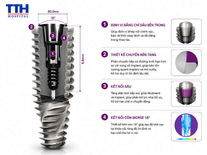 Những ưu điểm nổi bật của Implant Neodent