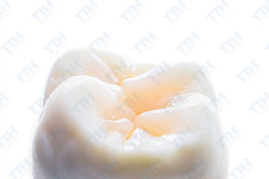 Những ưu điểm nổi bật của răng sứ Orodent