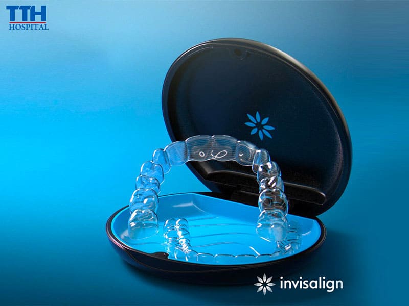 Niềng răng Invisalign – Lựa chọn lý tưởng cho người trưởng thành