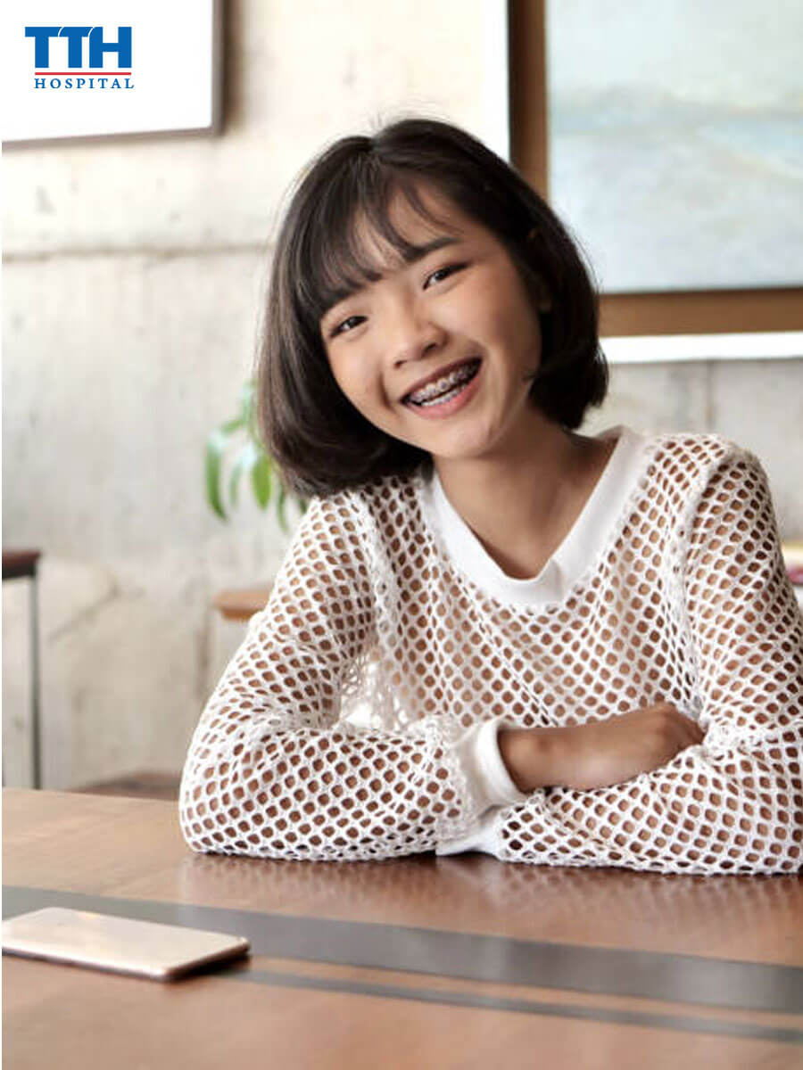 Niềng Răng Trẻ Em Nên Ở Độ Tuổi Nào