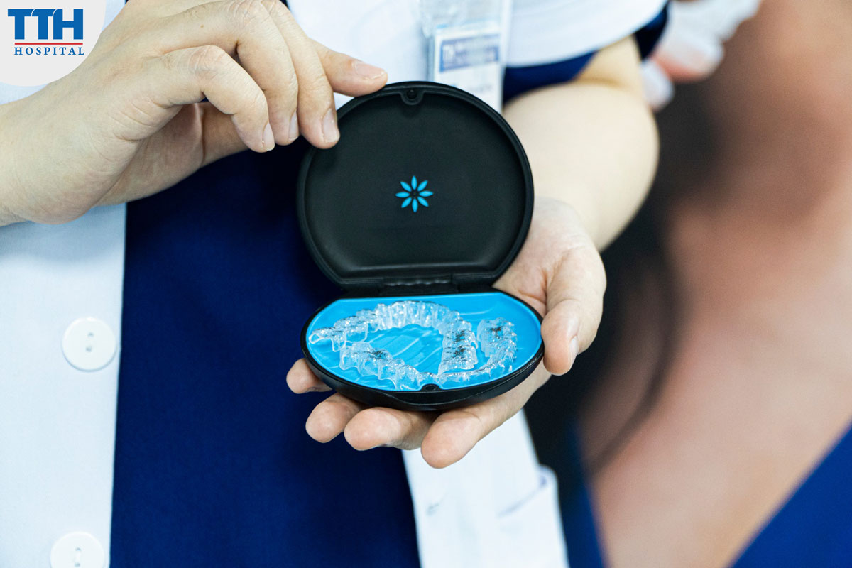 nvisalign được thiết kế để mang lại sự thoải mái và tránh gây tổn thương cho răng và nướu