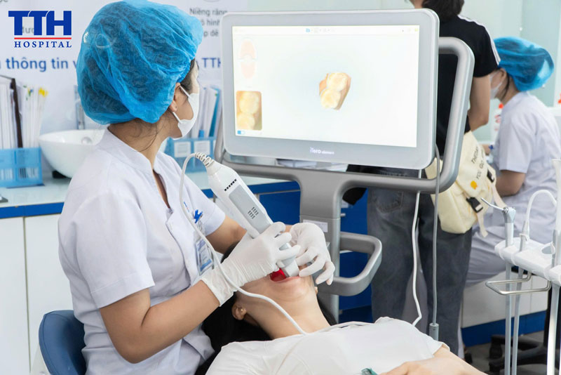 Niềng răng trong suốt - Giải pháp chỉnh nha hiện đại