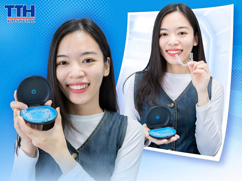 Niềng răng trong suốt tại Bệnh viện Thái Thượng Hoàng – Đầu tư cho nụ cười tự tin và bền vững