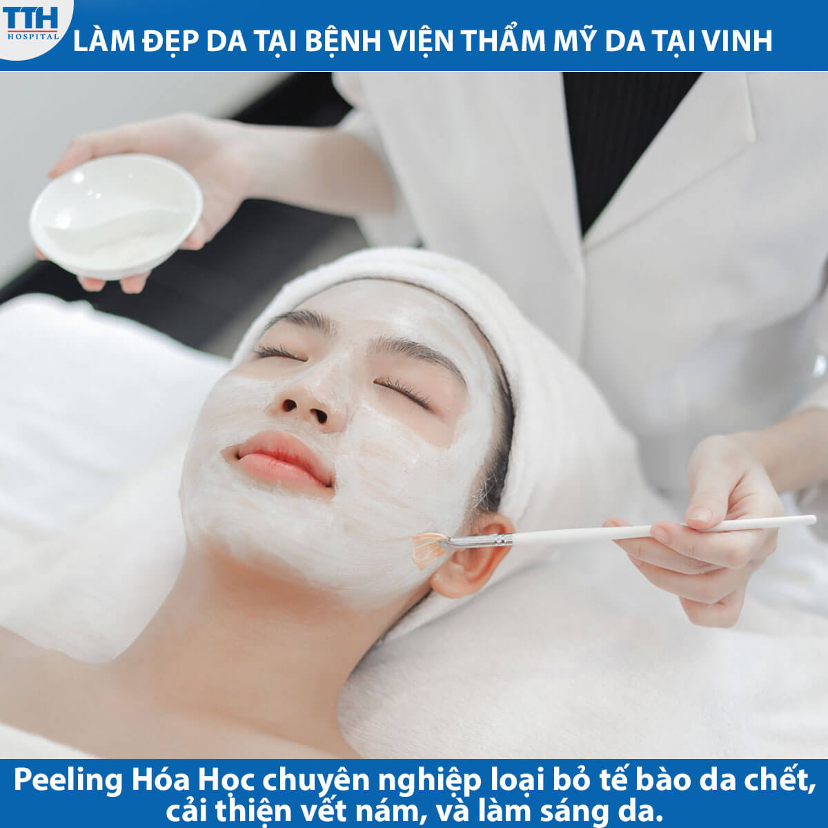 Peeling Hóa Học Chuyên nghiệp